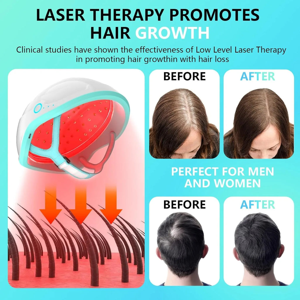 Wireless LLLT Hair Laser Cap 109pcs 650nm Laser Diodes Rechargeable Laser Helmet for Women Men Anti-Hair Loss Hair Growth Cap
