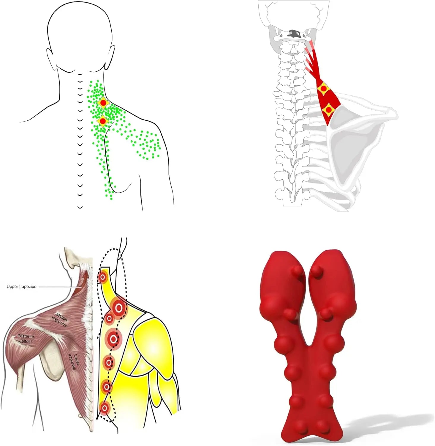 Manual Trapezius Massager for Neck, Shoulder & Upper Back Pain Relief - Trigger Point Tool